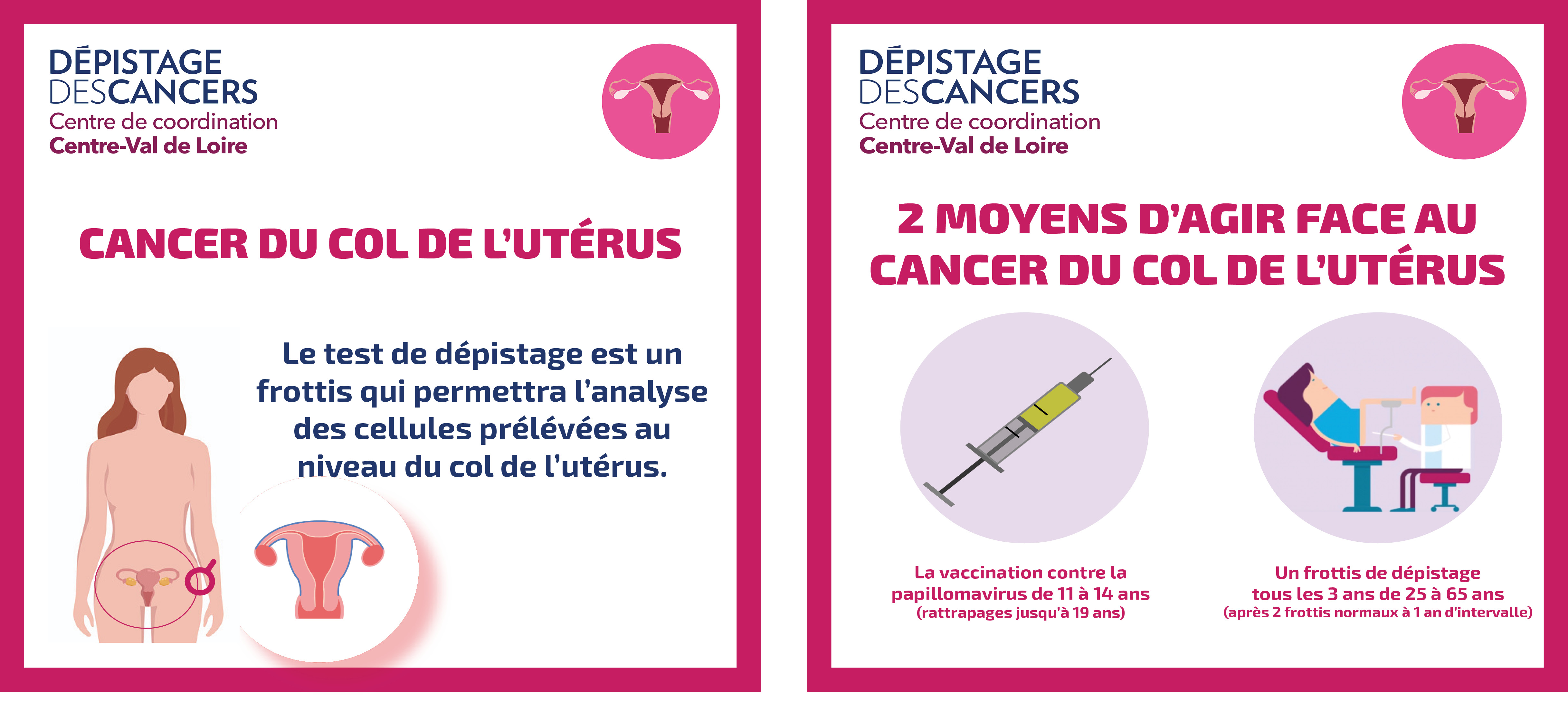 Semaine européenne de prévention du cancer du col de l’utérus